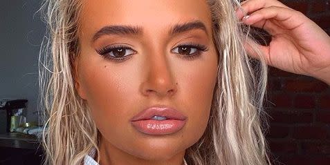 Love Island's Molly-Mae Hague gets her lip fillers dissolved