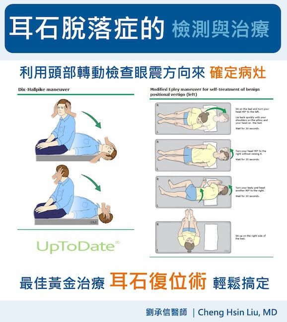 耳石脫落症免緊張，用耳石復位術（喬頭）快速搞定