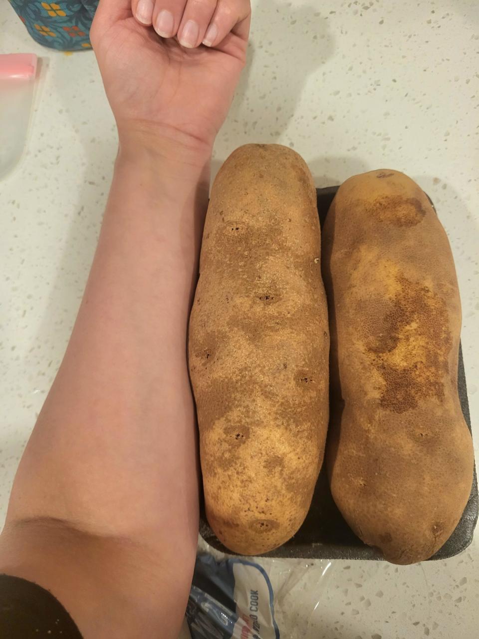 Two large potatoes next to a person's arm