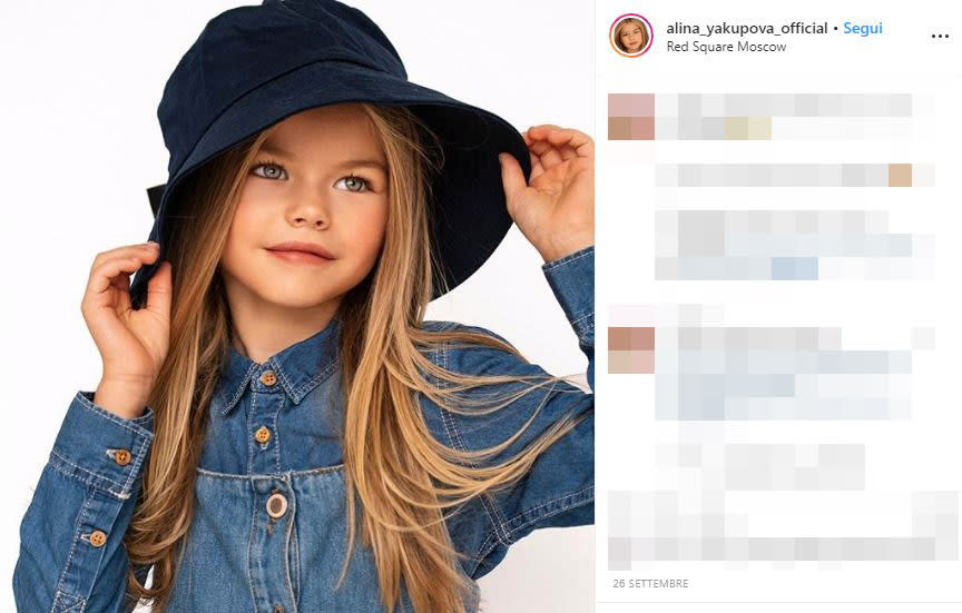 Yakupova è rappresentata dall'agenzia di moda per bambini, President Kids (PK) Management, la stessa che seguiva un'altra giovane modella russa, Anastasia Knyazeva. Quest'ultima si era guadagnata nel 2016, all'età di 6anni, lo scettro di "bambiba più bella del mondo". Prima di loro il titolo era nelle mani della modella francese Thylane Blondeau, figlia del calciatore Patrick Blondeau, che oggi ha 18 anni.