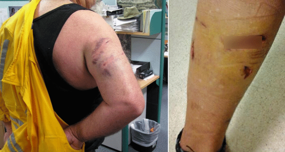 From January 14, Energex and Ergon workers will not enter Queensland yards with unrestrained dogs after a spate of dog attack injuries (pictured). Source: Supplied/ Energex