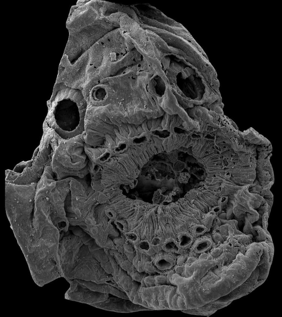 Una imagen muy detallada al microscopio del Saccorhytus coronarius