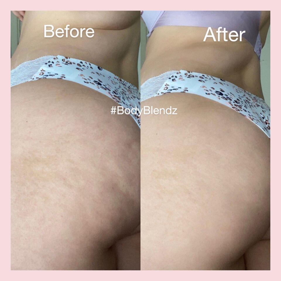 bodyblendz-before-after-2