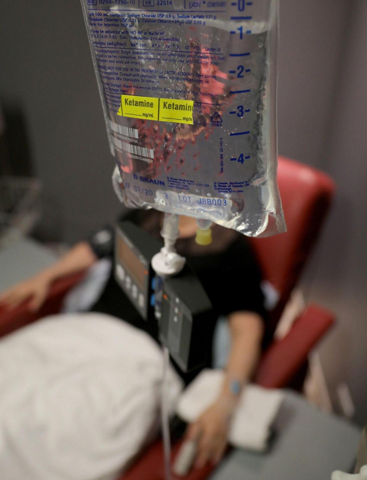 A patient having ketamine administered by way of an intravenous infusion