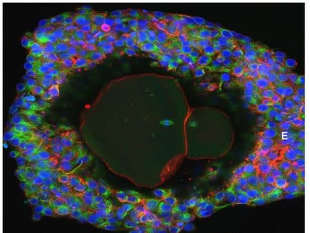 An undated picture shows a magnification of a lab-grown fully matured human egg ready for fertilization. Doctor David Albertini/University of Edinburgh/Handout via REUTERS