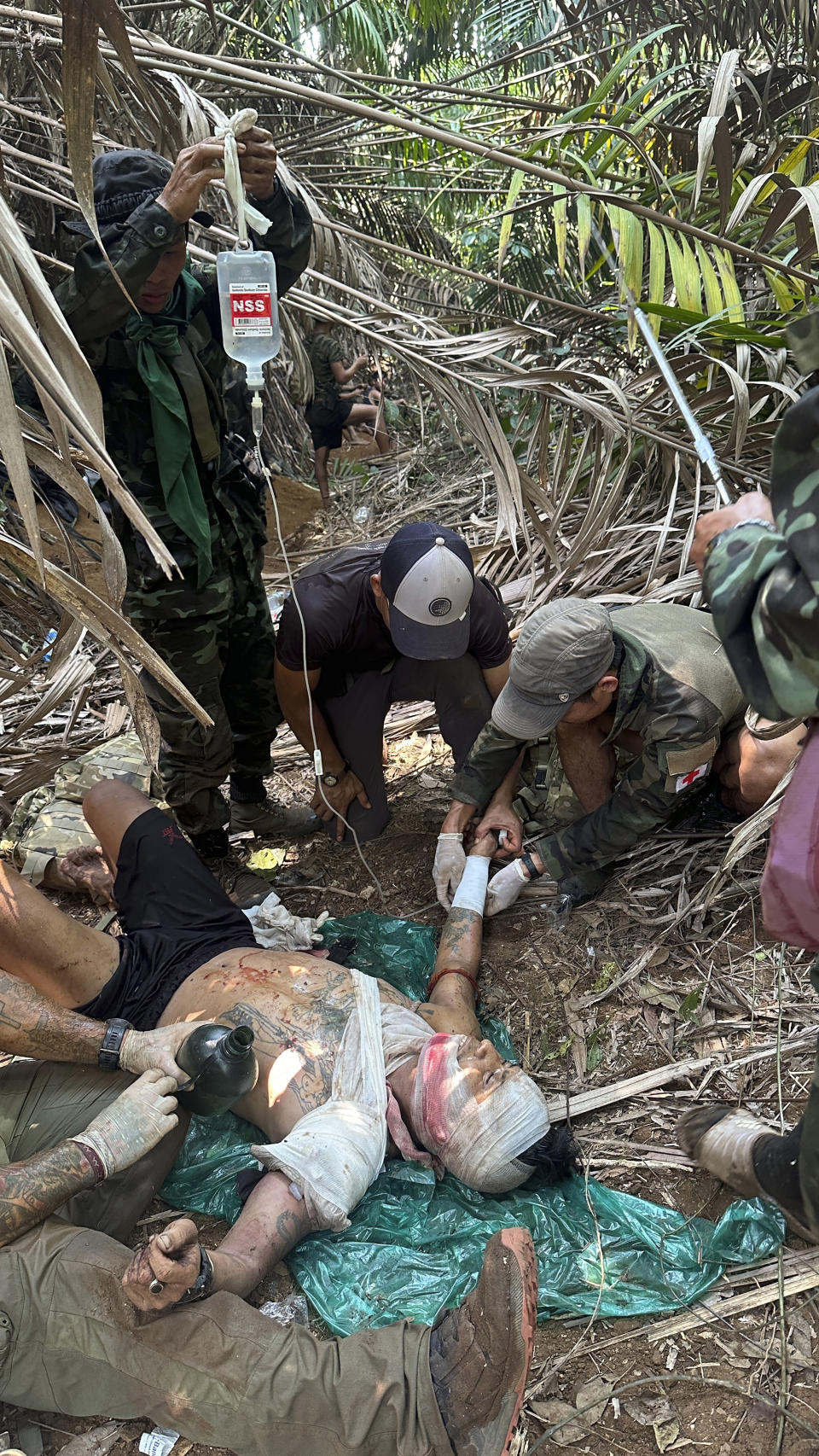 In this photo released by the Free Burma Rangers, a wounded person is treated in Karen state, Myanmar on April 24, 2024. (Free Burma Rangers via AP)
