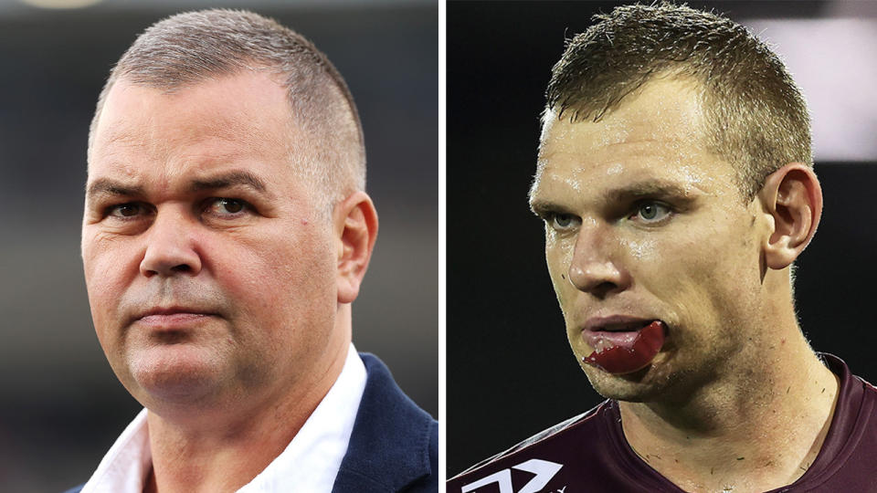 Manly coach Anthony Seibold during a game and Tom Trbojevic looks on.