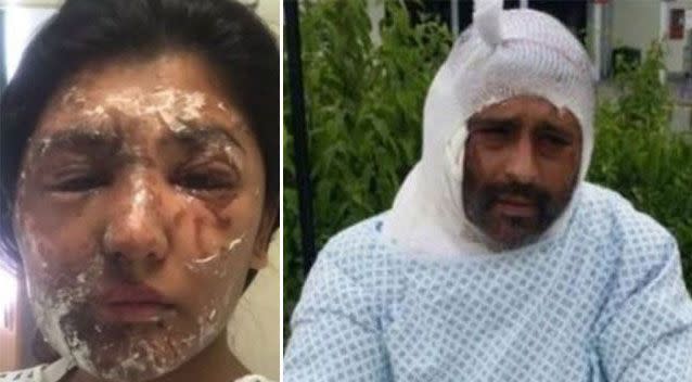 Resham Khan and Jameel Muhktar were left with significant burns to their faces. Source: PA