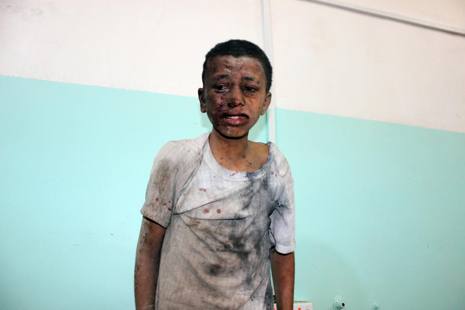 <p>A Yemeni child awaits treatment at a hospital after he was wounded in a reported air strike on the Iran-backed Huthi rebels’ stronghold province of Saada, Aug. 9, 2018. (Photo: Stringer/AFP/Getty Images) </p>