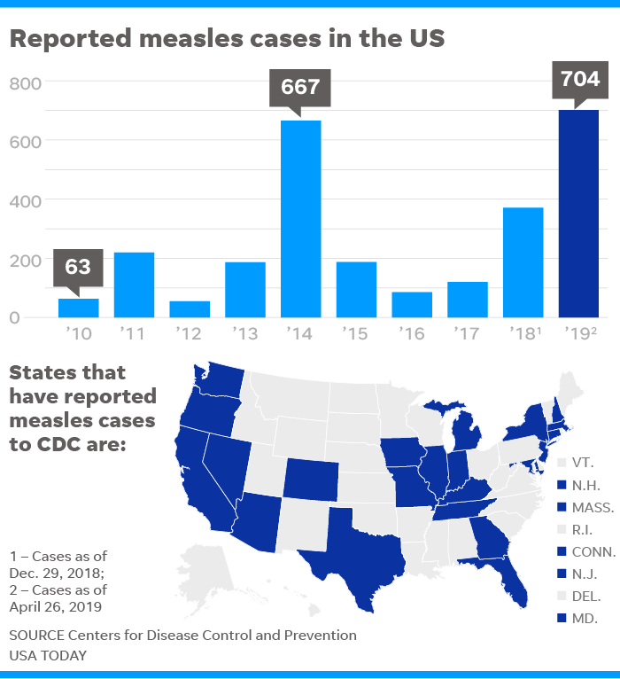 042919-Measles-outbreak