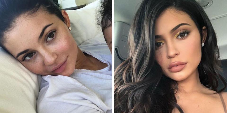 <p>Kylie Jenner just posted a makeup-free selfie and we're living for those freckles. ✨</p>