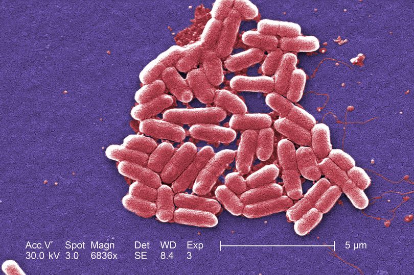 E.Coli bacteria (Centers for Disease Control and Prevention/PA)