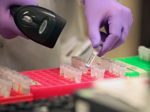 Chancellor Rishi Sunak tests samples at the pathology labs at Leeds General Infirmary on March 12