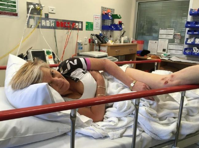 This Woman's Breast Implants Popped When She Was Attacked By A Kangaroo