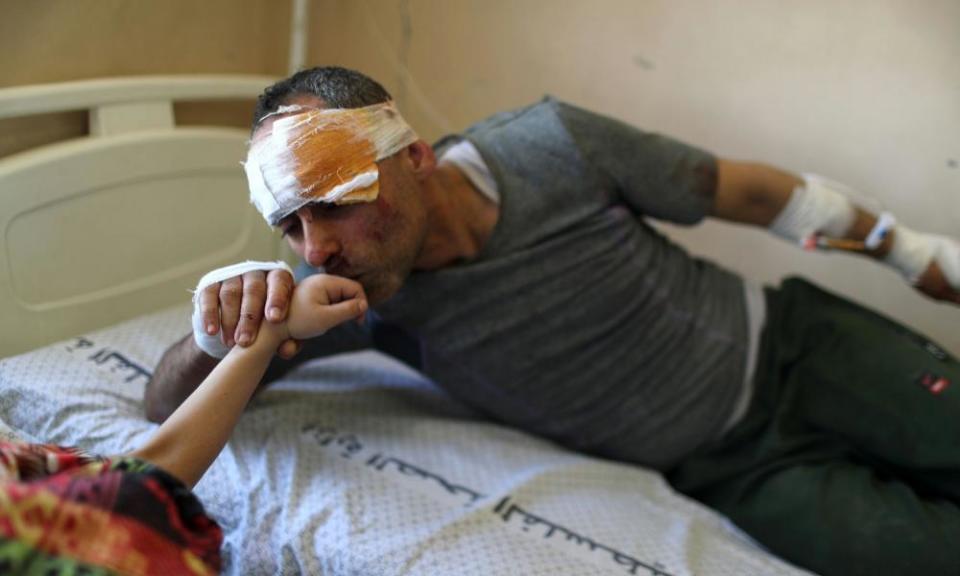 Riyad Eshkuntana kisses his daughter Suzy’s hand as they are treated at a hospital after being pulled from the rubble of a building