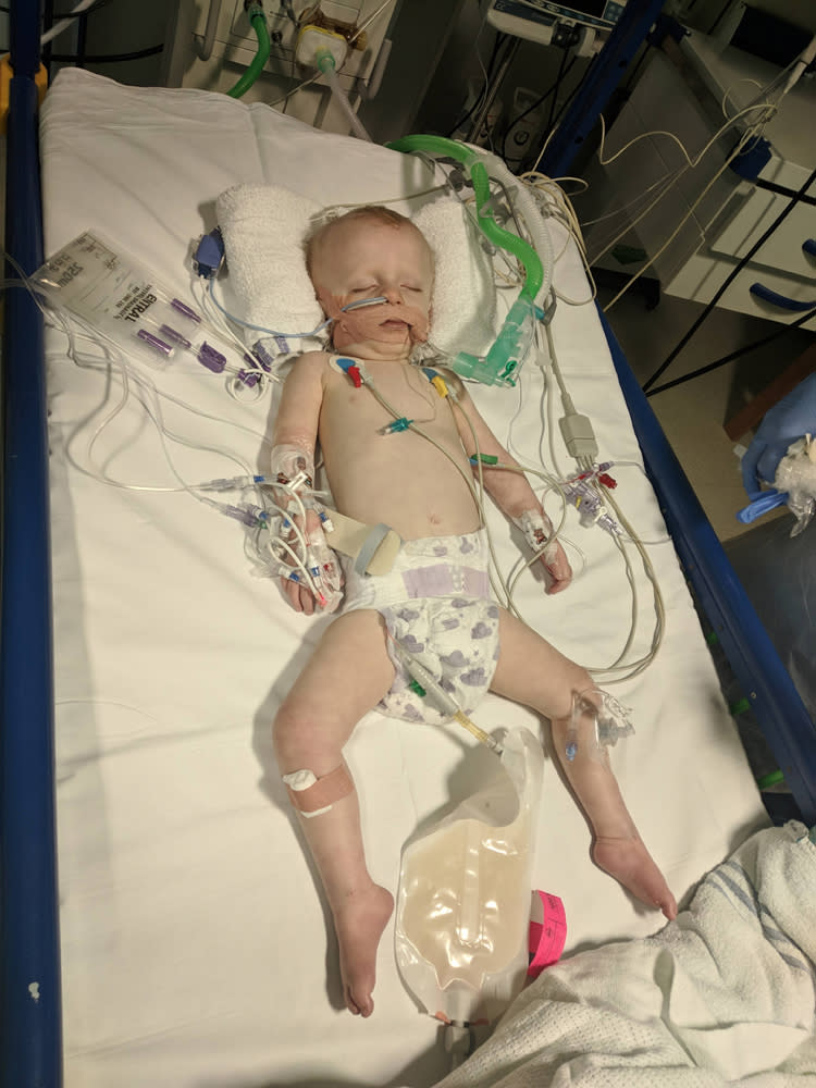 Lex in hospital in December 2018 after he stopped breathing (Collect/PA Real Life)