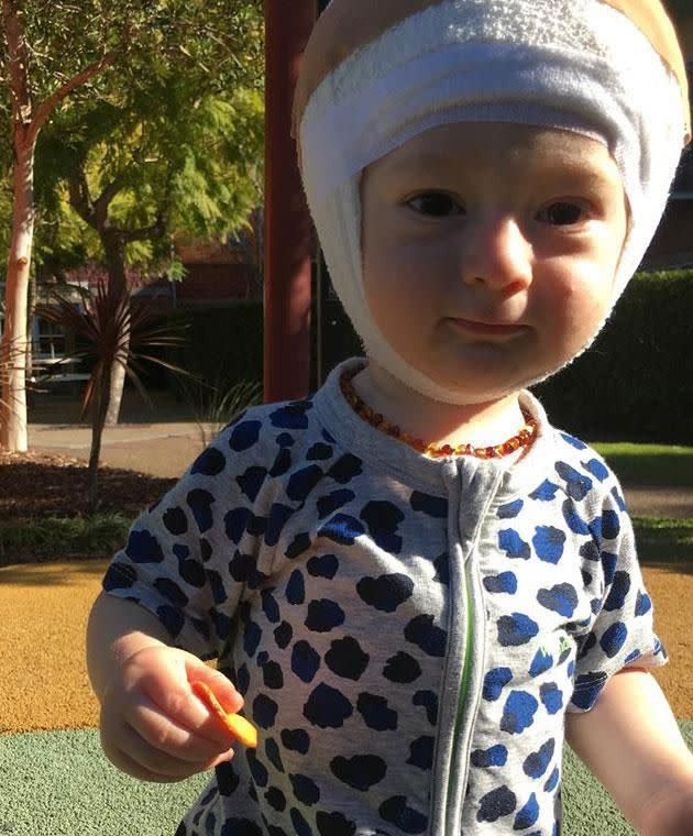 Nixon has had a bandage on his head his whole life. Photo: Supplied