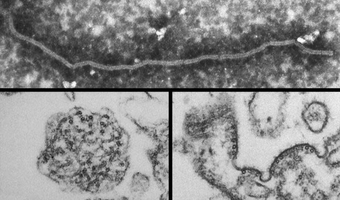 Estudio predice los virus que podrían causar la próxima pandemia  