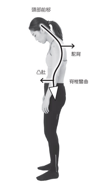 頭部向前突出的姿勢容易導致頸椎僵直