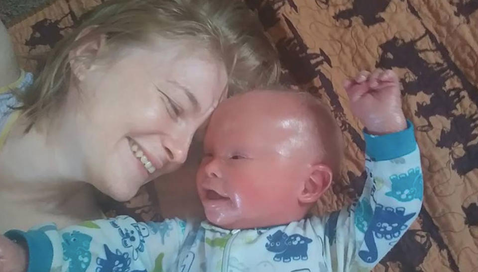 Alicia Barber with son Jamison. Source: Facebook/ Jamison, Little Butterfly-Harlequin Ichthyosis