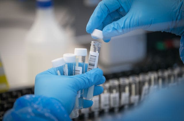 PCR test samples