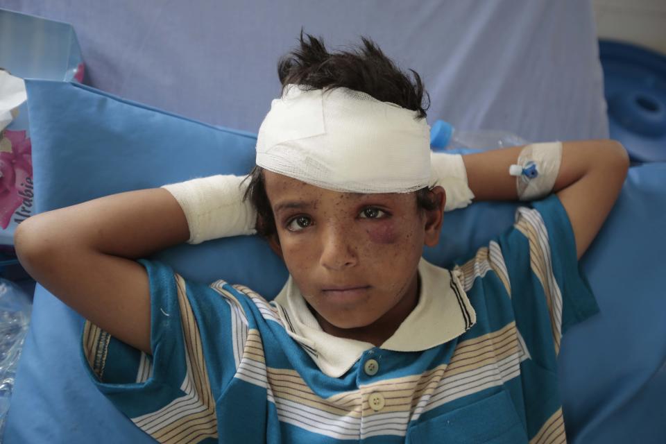 A child injured in a deadly Saudi-led coalition airstrike on Thursday rests in a hospital in Saada, Yemen, Sunday, Aug. 12, 2018. Y(AP Photo/Hani Mohammed)