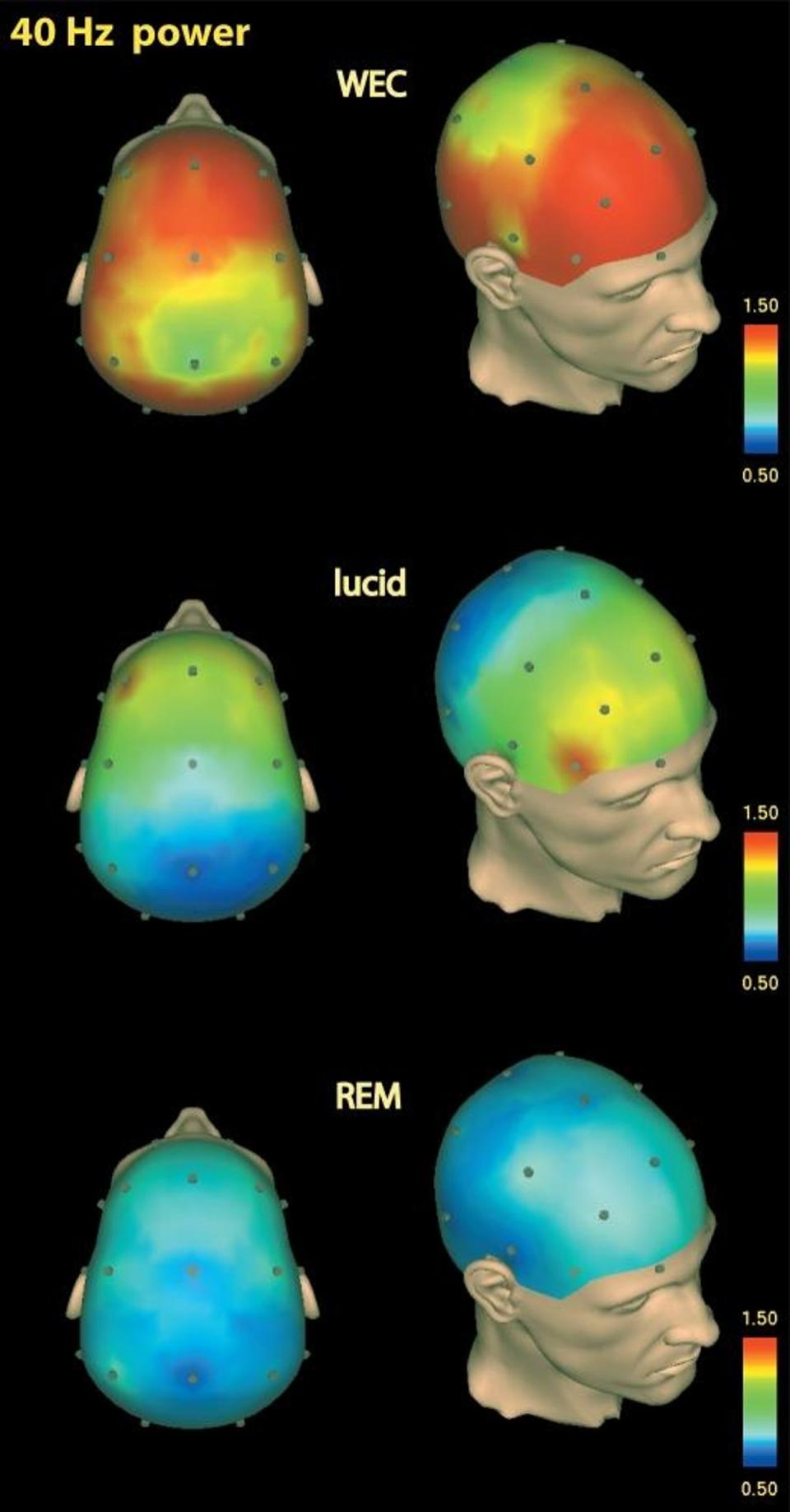EEG differences in brain activity in the WEC state and REM sleep, compared with brain activity during lucid dreaming [Click to expand] (CC)