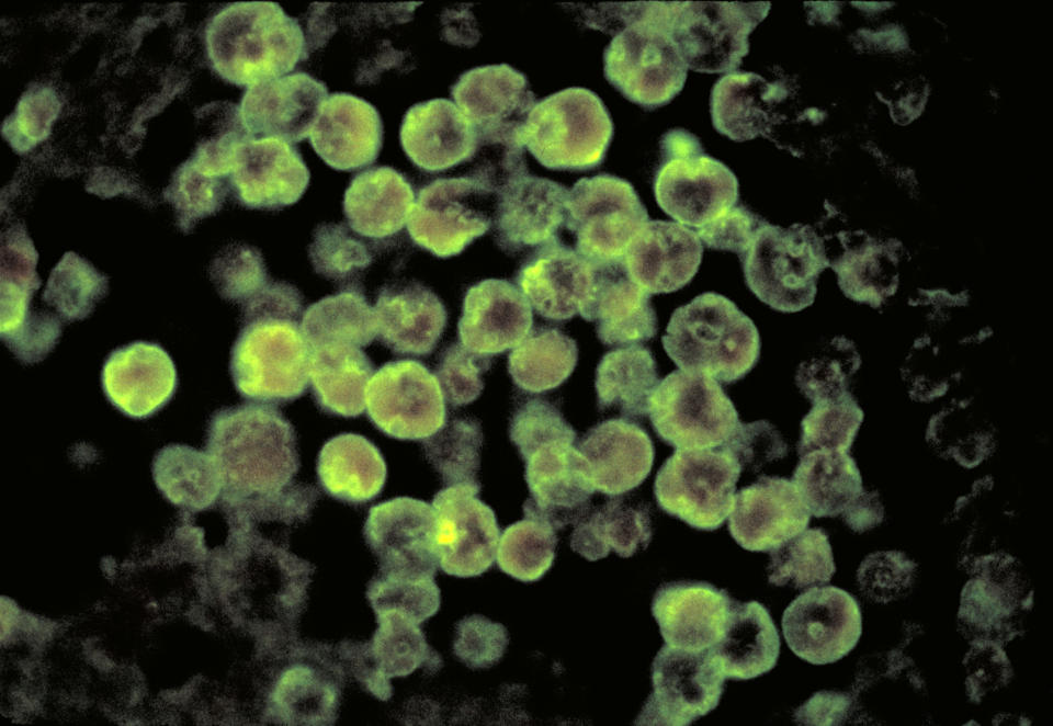 Naegleria fowleri, also known as a brain-eating amoeba, taken through a microscope. (CDC)