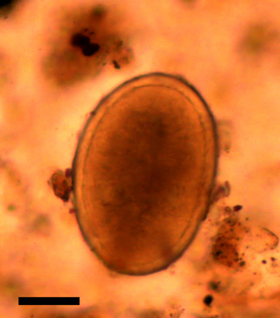 One of the roundword eggs found where King Richard III's intestines once lay.