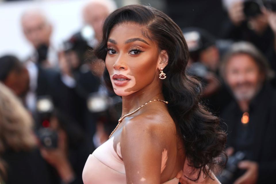 Winnie Harlow is one of the most prominent stars with vitiligo (AP)