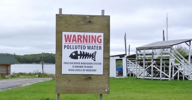 A sign in Grassy Narrows First Nation says "Warning: polluted water." Research shows that more than 90 per cent of the community's population is experiencing symptoms of mercury poisoning.