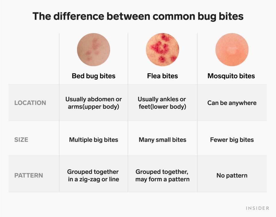 bug bite comparison table