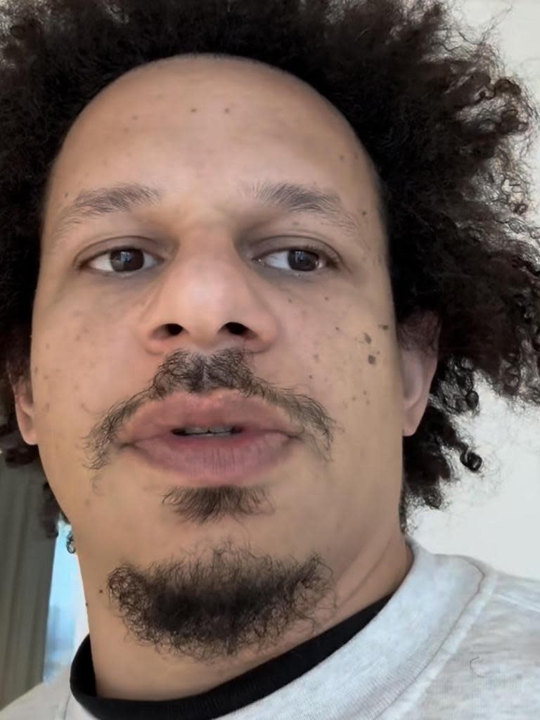 Comedian Eric André claimed he was the victim of racial discrimination at Melbourne Airport on Monday. Image: Instagram.