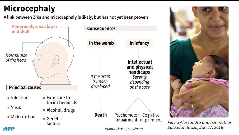 Illustrated description of microcephaly, a rare condition that shrinks the brains of unborn babies