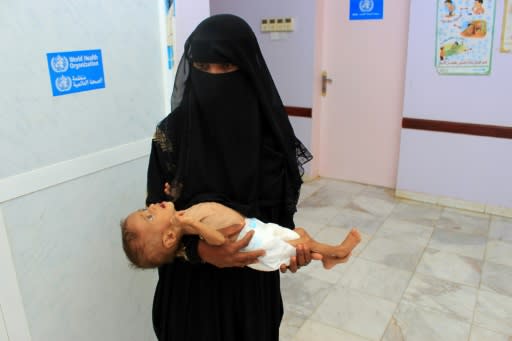 A Yemeni woman carries her child who is suffering from severe malnutrition at a hospital in northwestern Hajjah province on November 11, 2018