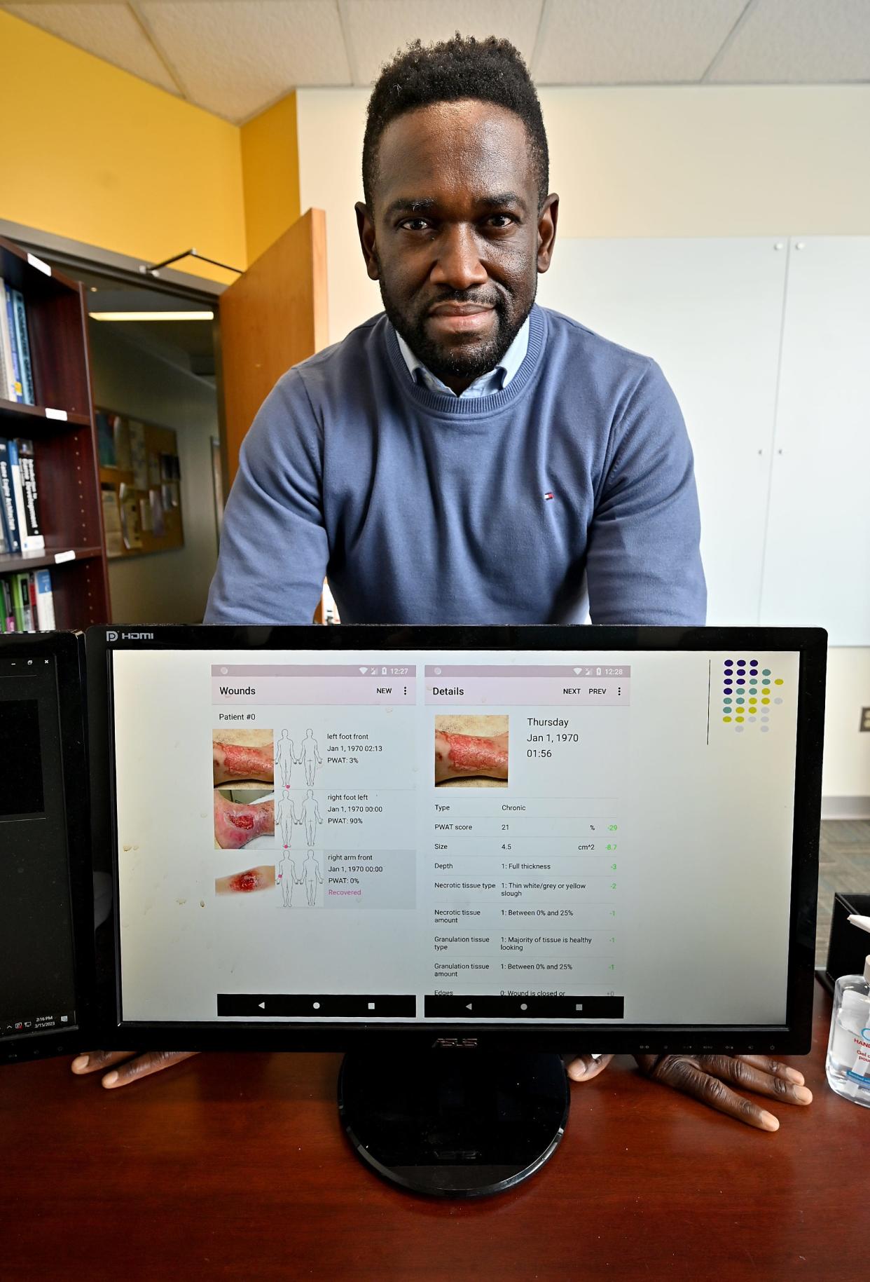 A team led by Worcester Polytechnic Institute researcher Emmanuel Agu and UMass Chan Medical School has been awarded $2.4 million by the National Institutes of Health to develop a smartphone app that will use photographs, heat images, and algorithms to detect infections in the open wounds of patients at home. ​