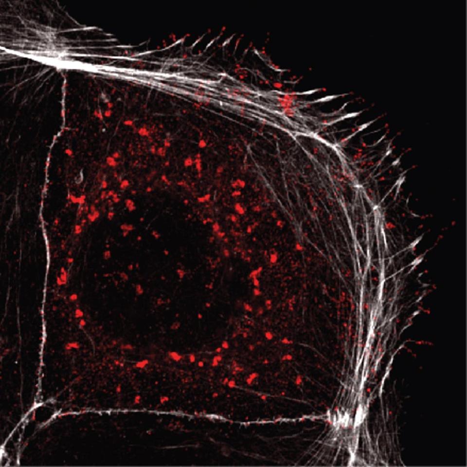 <div class="inline-image__caption"><p>Microscope image shows a cell infected with SARS-CoV-2 and filopodia growths (in white) extending out from the cell surface containing viral particles (in red).</p></div> <div class="inline-image__credit">Elsevier/The Conversation</div>