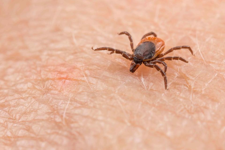 <p>Getty Images/iStockphoto</p> Tick-bourne illnesses are on the rise