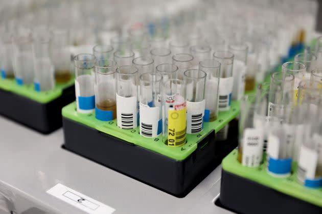 PCR test specimens are seen at a microbiology laboratory in Madrid, Spain. The hospital has begun PCR testing for monkeypox. (Photo: Europa Press News via Getty Images)