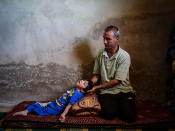 <p>A Syrian man named Ahmed sits next to his daughter Reem, who suffers from disabilities due to injuries sustained in government shelling, at their home in Daraa, Syria, on May 30, 2016. According to local sources, Ahmed has two daughters who suffer from disabilities due to injuries they sustained in government shelling two years ago in Daraa al-Balad. The father is not working, and treatment became unavailable as of a year ago. (Mahmoud Al-Hamza/EPA) </p>