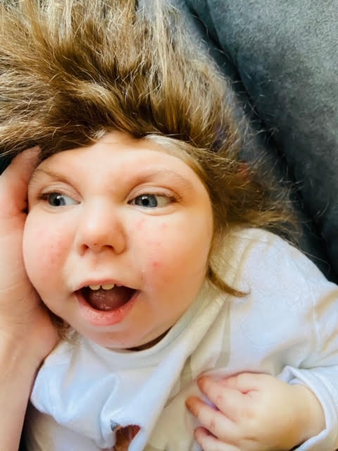 Jaxon Strong Boy Born With Part Of Brain Missing Dies At 5 4180