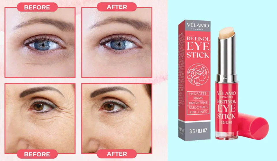 a series of before and after photos and the retinol eye stick