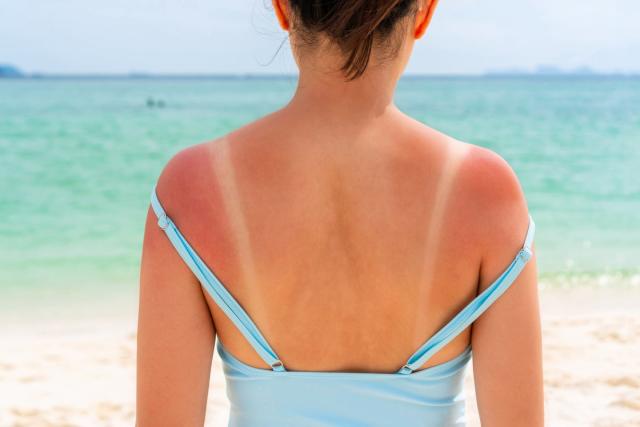 Non, les UV des cabines de bronzage ne préparent pas la peau au soleil –  L'Express