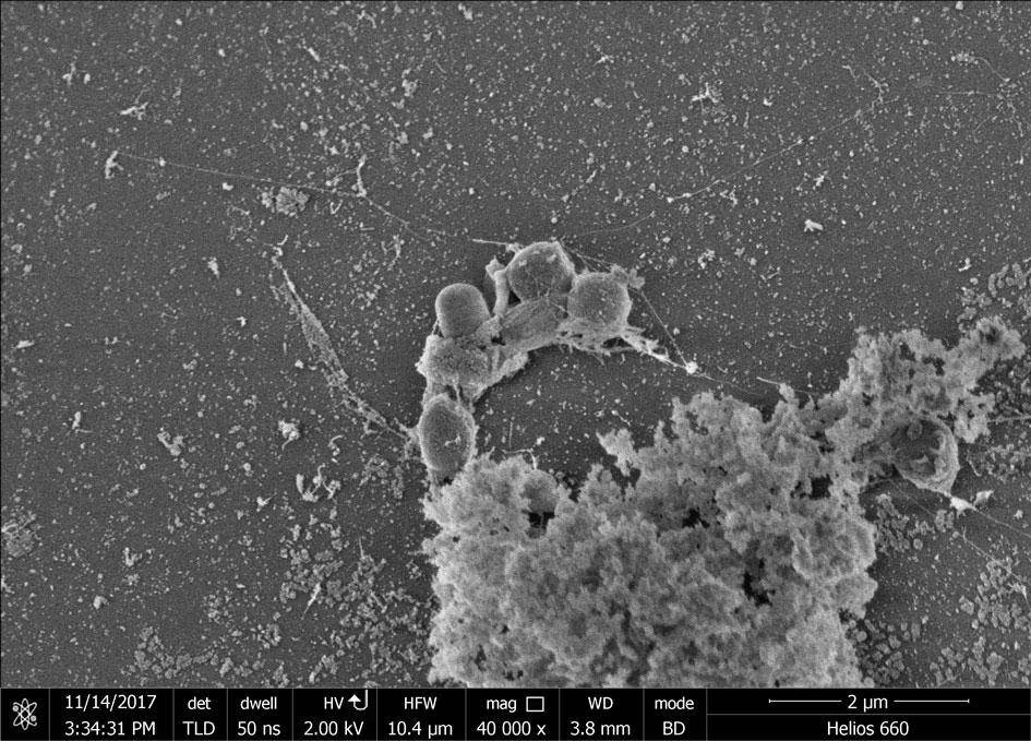 Image reveals colonies of bacteria growing on a strip of PET plastic (Claudia Lopez/Oregon Health Science University)