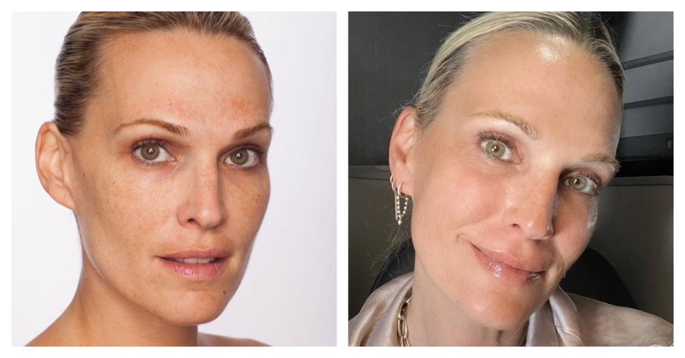 Molly Sims' go-to skincare routine (before and after)<p>Courtesy Molly Sims</p>