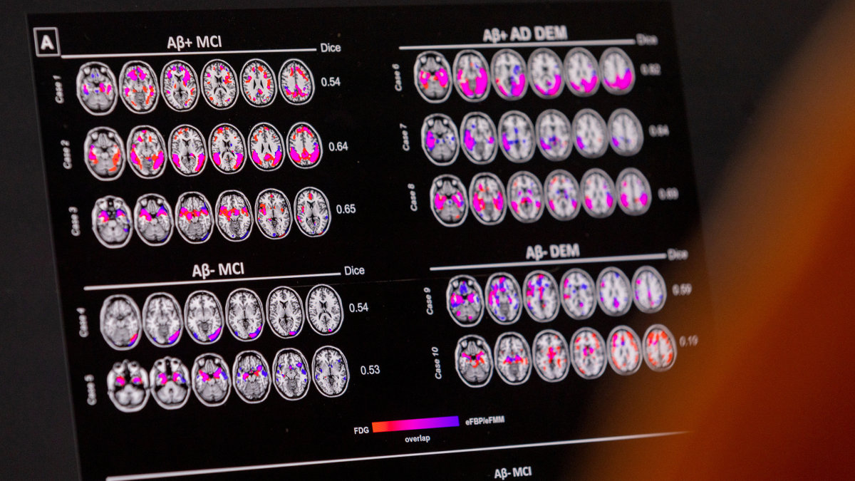 FDA panel backs new Alzheimer’s drug, Apple unveils new AI and iOS features and Warner Bros. announces ‘Practical Magic’ sequel