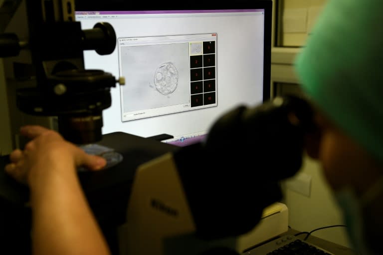 Un embrión en etapa de blastocito, observado al microscopio en una clínica de fertilidad de Barcelona el 25 de mayo de 2016 (Lluís Gené)
