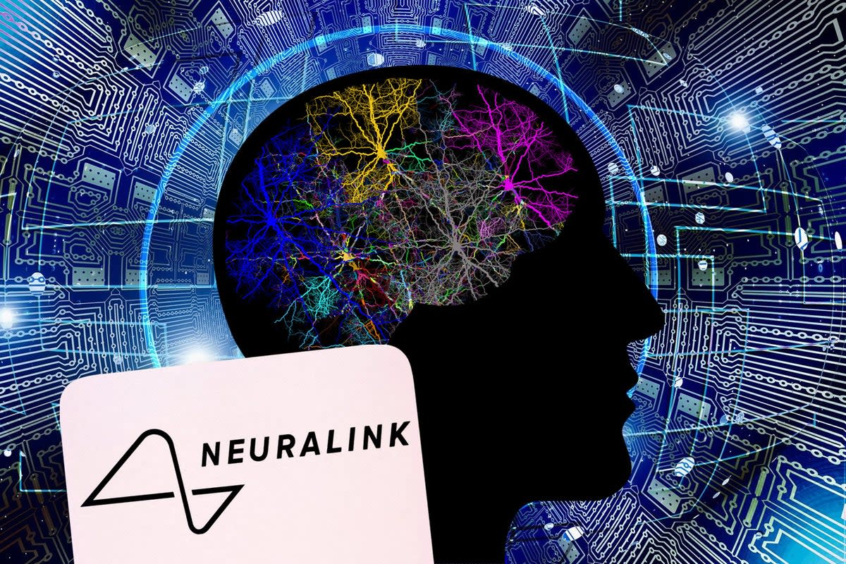 Neuralink aims to create devices to be implanted into the human brain, allowing direct communication between the brain and external devices or software (ES Composite)