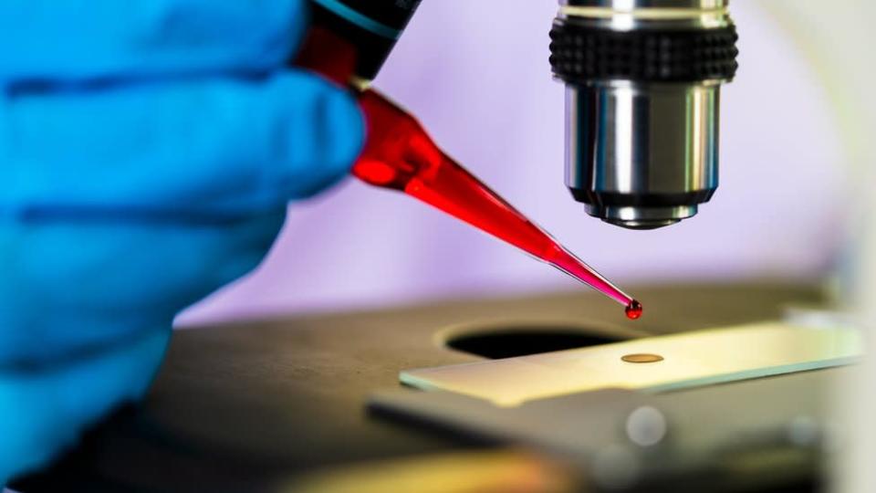 Microscopio y una gota de sangre en un laboratorio