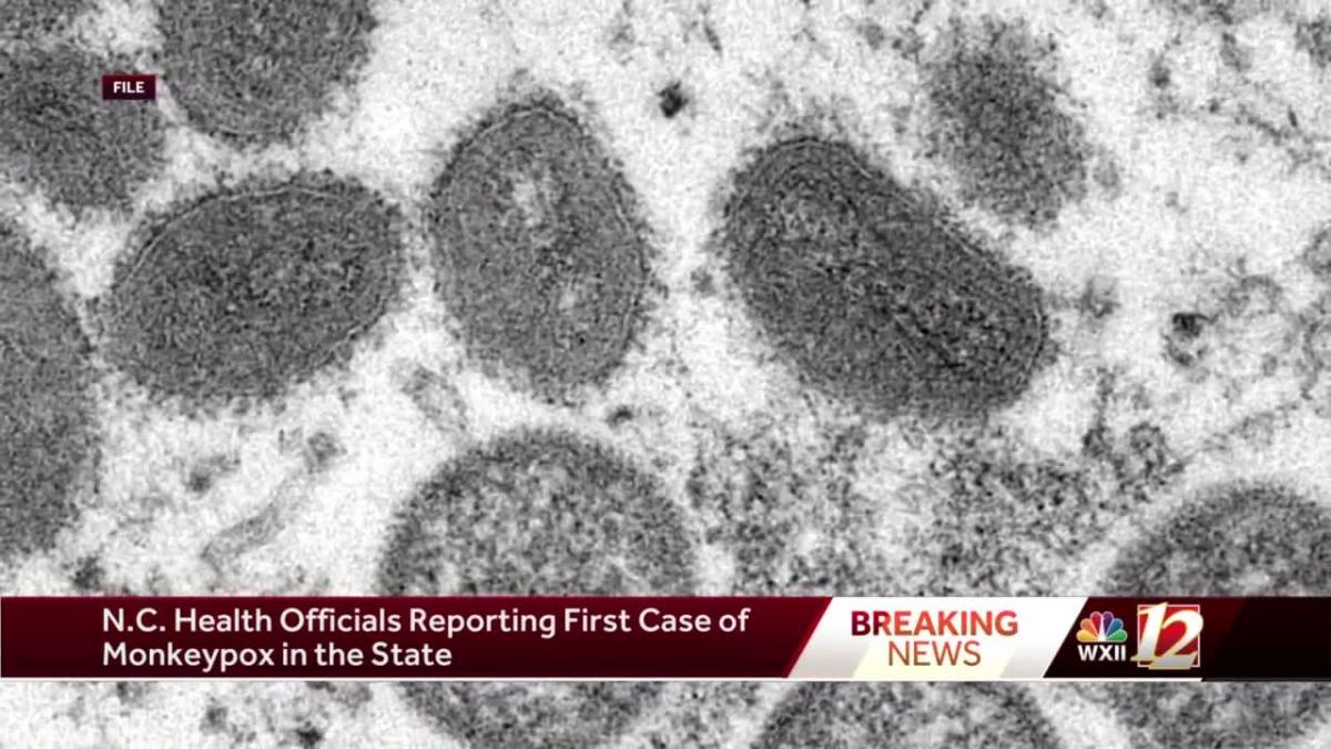 First case of monkeypox in North Carolina reported